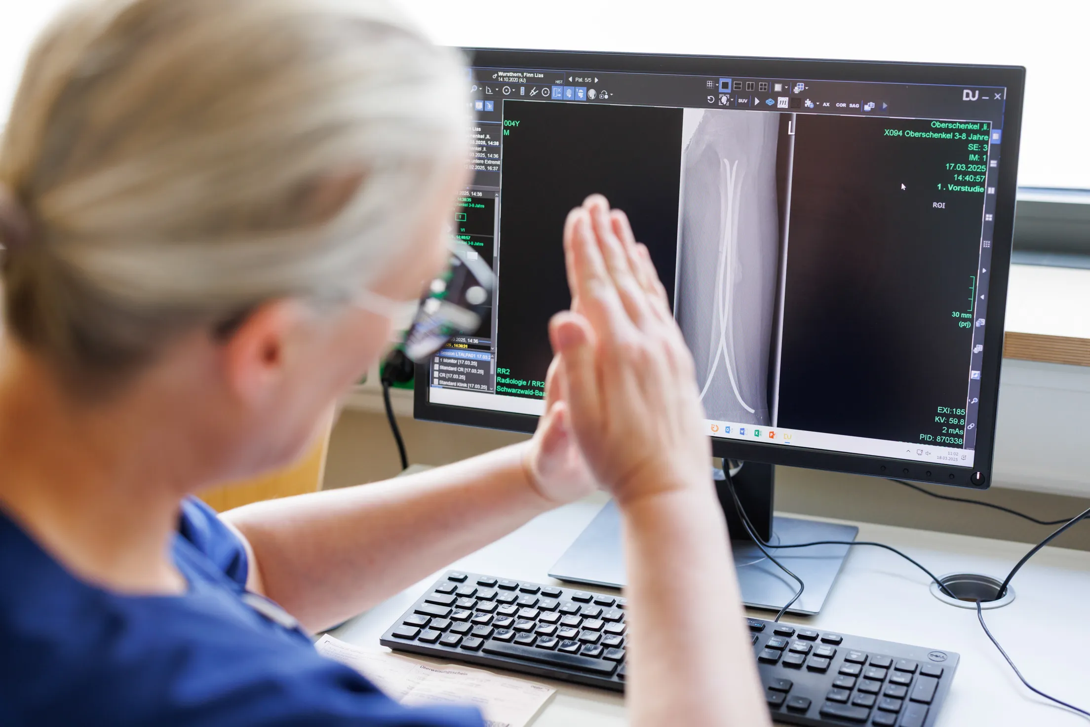 Blick leicht von oben über die Schulter einer Ärztin mit blauem Kasack, blonden Haaren und Brille. Sie sitzt links im Anschnitt vor einem Monitor. Von ihr ist nur ihr Kopf, Schulter und ihre Hände zusammengelegt zu sehen. Sie zeigt etwas mit ihren Händen vor dem scharfabgebildeten Monitor. Auf dem schwarzen Bild des Computers ist die Röntgenaufnahmen einer Elle und Speiche von einem Kind zu sehen.